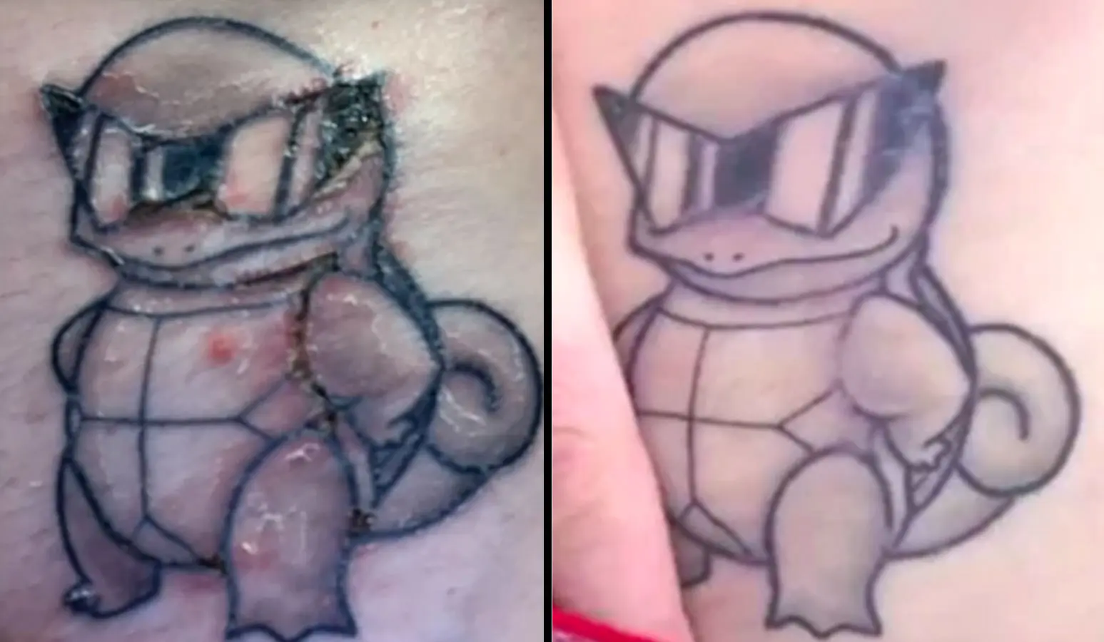 logan paul's squirtle tattoo